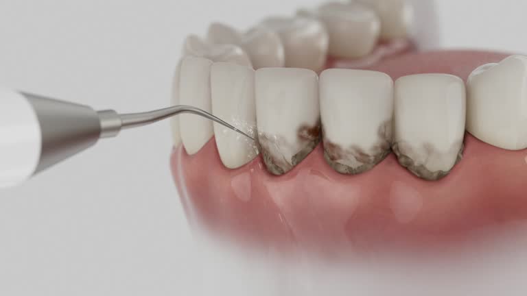 Reliable Dental Implants contractor in Independence, OR by Smile Center Dentistry